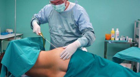 Bellezza, i dati Aicpe: quasi un milione i trattamenti di medicina e chirurgia estetica eseguiti nel 2013