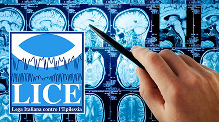 A Reggio una giornata dedicata a chi soffre di epilessia Consultazioni gratuite a cura dell'Associazione LICE per una delle patologie neurologiche più diffuse. In Calabria sono circa 16.000 i malati