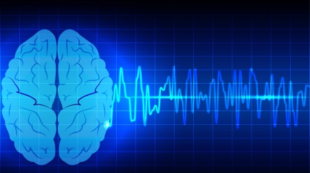 L’ utilizzo dell’Intelligenza Artificiale nella presa in carico del paziente colpito di Ictus cerebrale progetto innovativo dell’Azienda Dulbecco (progetto Stroke 5.0)