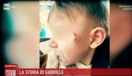 Palmi, il piccolo Gabriele vittima di una presunta violenza in asilo, 60 morsi sul corpo Il caso è stato derubricato per mancanza di prove, ma Laura e Giuseppe, i genitori, distrutti ma determinati, hanno deciso di raccontare la loro storia pubblicamente